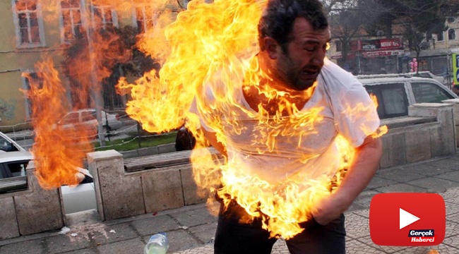 Kendisini benzinle yakmıştı, şimdi ocağı bile yakamıyor