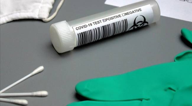 Tokyo hükümetinden Pekin'e: "Anal Kovid-19 testi istemiyoruz!"