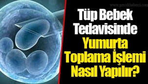 Tüp Bebek Tedavisinde Yumurta Toplama İşlemi Nasıl Yapılır?