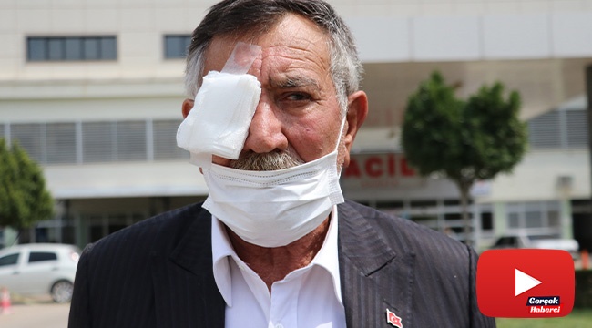 50 kuruşluk tuvalet parası için gözünden oldu!