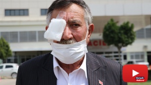 50 kuruşluk tuvalet parası için gözünden oldu!