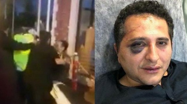‘Yol neden kapalı’ diyen avukatı döven cumhurbaşkanlığı korumalarına takipsizlik