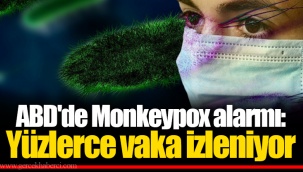 ABD'de Monkeypox alarmı: Yüzlerce vaka izleniyor