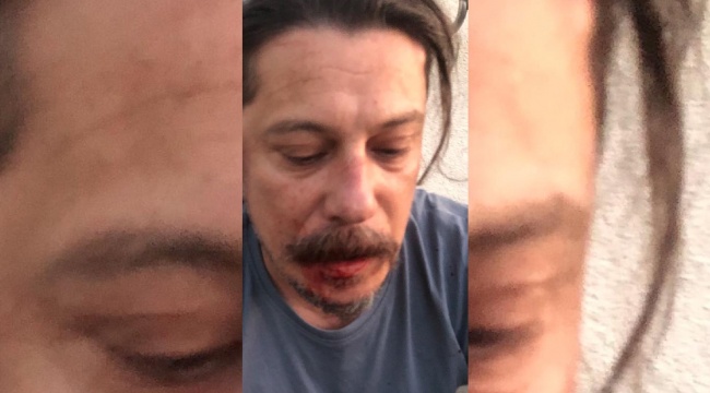Gazeteci Erk Acarer’e saldırı