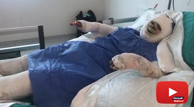 Üzerine benzin döküp ateşe verdiği kayınvalidesinin alevler içinde yanmasını izledi