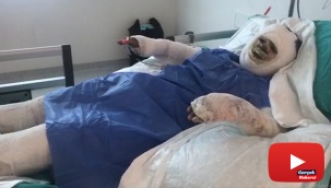 Üzerine benzin döküp ateşe verdiği kayınvalidesinin alevler içinde yanmasını izledi