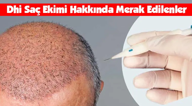 DHİ Saç Ekimi Hakkında Merak Edilenler