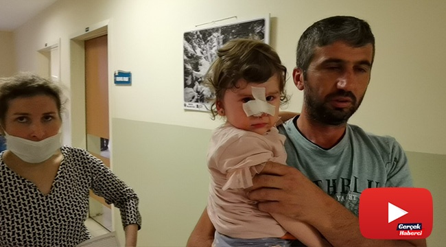 Köpeğin saldırısına uğrayan çocuğu babası zor kurtardı