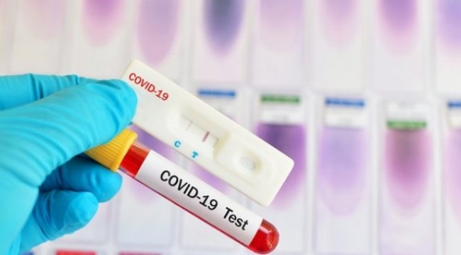 Bakanlık duyurdu: Koronavirüs aşısı yaptırmayan işçilerden her hafta PCR testi istenebilecek