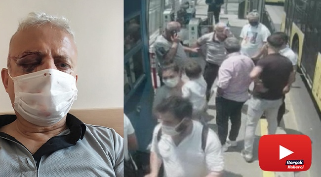 Maske uyarısında bulunduğu şahıs tarafından darp edilen güvenlik görevlisi görme yetisini kaybetti