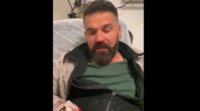 Arif Kocabıyık paylaştı: AK Partili Savcı Sayan bir işçiyi darp etmiş