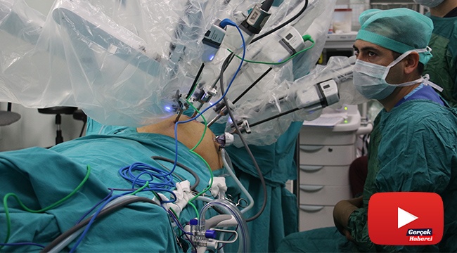 Bu sistem adeta cerrahların eli kolu: “Robotik cerrahi”