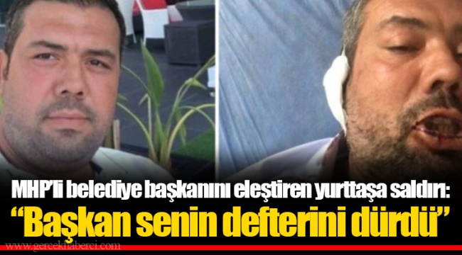 MHP’li belediye başkanını eleştiren yurttaşa saldırı: “Başkan senin defterini dürdü”