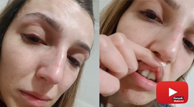 Mahalle muhtarı eski sevgilisine dehşeti yaşattı