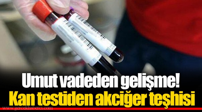 Umut vadeden gelişme! Kan testiden akciğer teşhisi