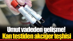 Umut vadeden gelişme! Kan testiden akciğer teşhisi