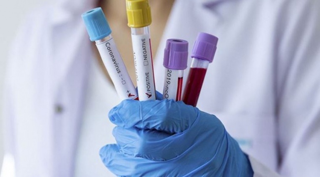 Galatasaray Kadın Basketbol Takımı'nda 6 pozitif vaka