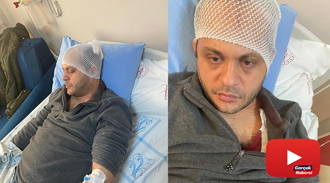 Gaziantep’te hasta yakınından doktora mermerli saldırı
