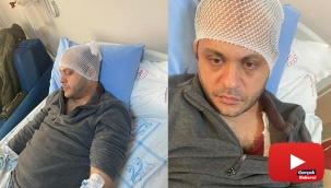 Gaziantep’te hasta yakınından doktora mermerli saldırı
