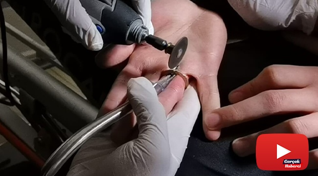 1 liranın ortasındaki kısmı çıkardı, metal bölüm parmağına sıkıştı