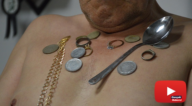 ‘Mıknatıs adam’ı gören bir daha dönüp bakıyor