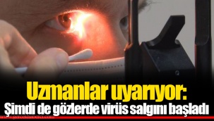 Uzmanlar uyarıyor: Şimdi de gözlerde virüs salgını başladı