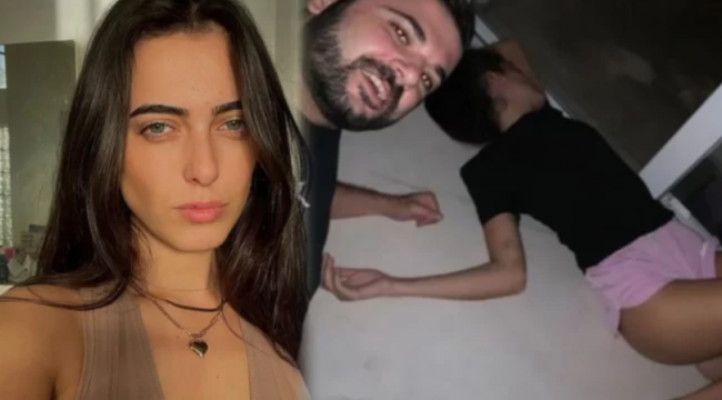 Türkiye’yi dehşete düşüren olay: İrem Ay isimli kadın, eski eşi Berkay Saner tarafından uğradığı işkencenin görüntülerini paylaştı