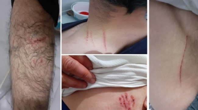 Polislerin “köpekle işkence” yaptığı iddia edilmişti; İçişleri Bakanlığı 60 bin TL tazminata mahkûm edildi