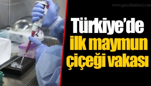 Türkiye'de ilk maymun çiçeği vakası