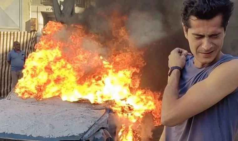 Sette korkunç kaza: İsmail Hacıoğlu'nun yüzüne fünye patladı