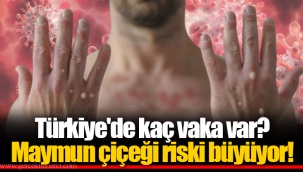 Türkiye'de kaç vaka var? Maymun çiçeği riski büyüyor!
