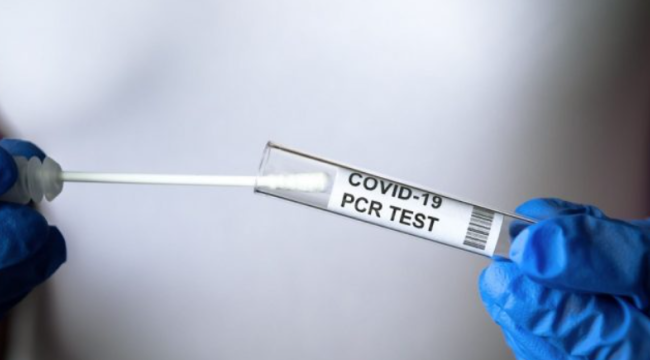Haftalık Covid-19 tablosu açıklandı: 15-21 Ağustos haftasında vaka ve ölüm rakamları