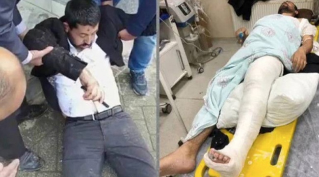 HDP'li Habip Eksik: Polisler 'ayağım kırıldı' dememe rağmen üstüne basıp tekmelediler