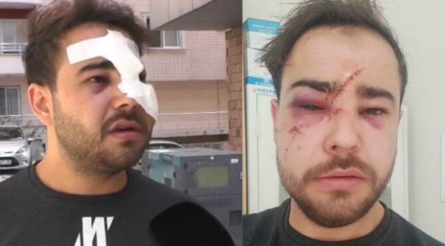 İkinci Onur Şener vakası! İstek parçayı çalmadı diye…
