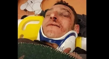 Seçmeni oy vermesin diye kaçırıp dövdüler