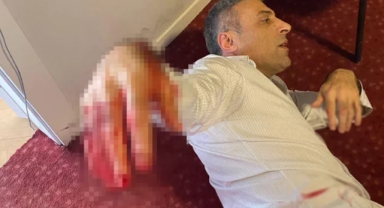 Yenilik Partisi Genel Başkanı Öztürk Yılmaz'a ofisinde bıçaklı saldırı!