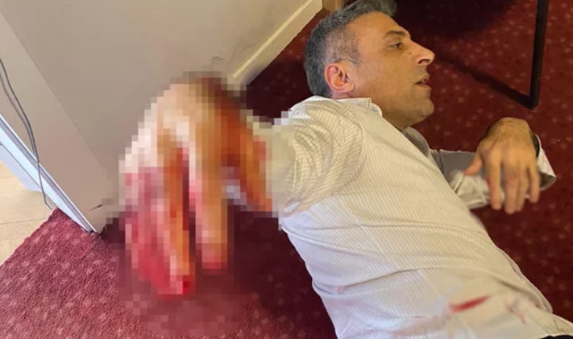 Yenilik Partisi Genel Başkanı Öztürk Yılmaz'a ofisinde bıçaklı saldırı!