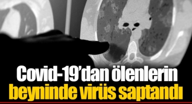 Covid-19’dan ölenlerin beyninde virüs saptandı