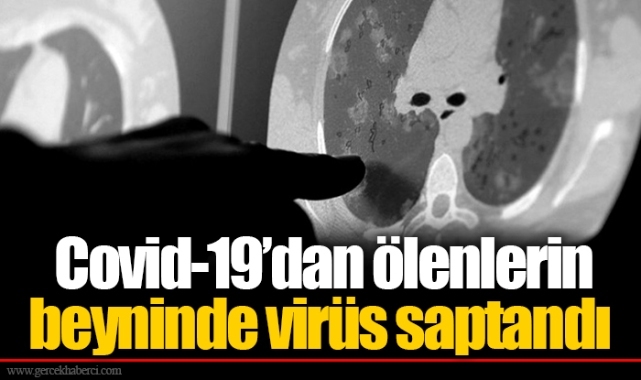 Covid-19’dan ölenlerin beyninde virüs saptandı