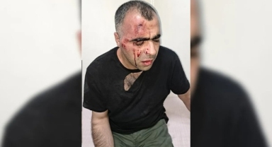 Gazeteci Sinan Aygül'e belediye başkanından özür