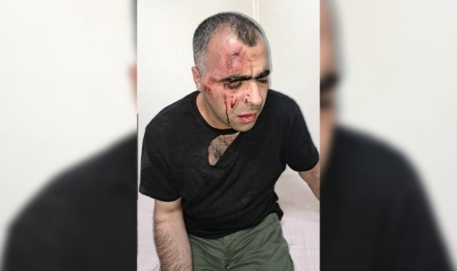 Gazeteci Sinan Aygül: Tatvan belediye başkanının korumalarının saldırısına uğradım