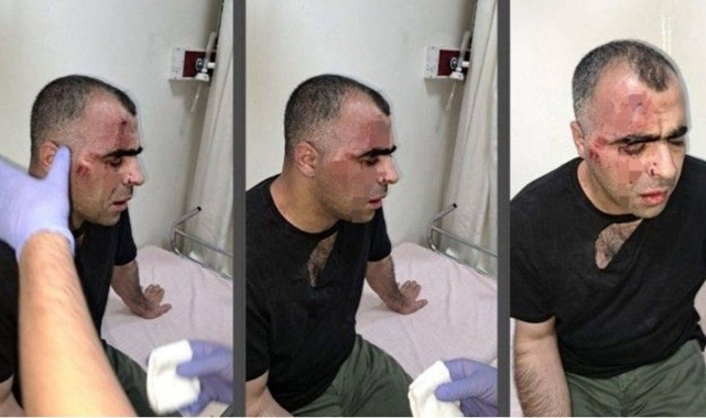 Gazeteci Sinan Aygül'ü darp eden 2 koruma tutuklandı