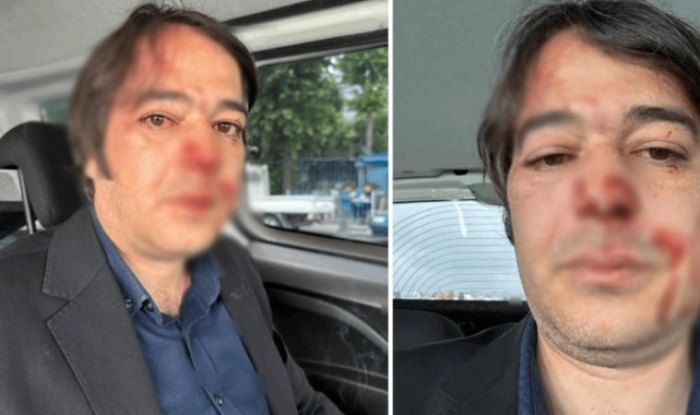 İBB yöneticisine saldıranlar parayla bırakıldı: Devlet memuruna saldırıp 1 milyon TL verirseniz serbestsiniz