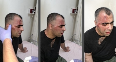 Sinan Aygül'e saldıran iki koruma, Aygül'ün kendilerine hakaret ettiğini ileri sürdü