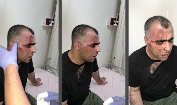 Sinan Aygül'e saldıran iki koruma, Aygül'ün kendilerine hakaret ettiğini ileri sürdü