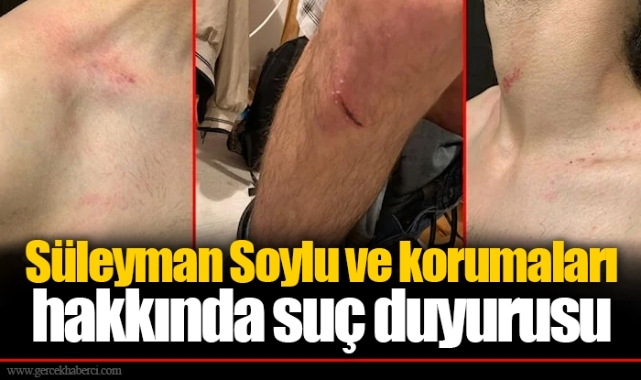 Süleyman Soylu ve korumaları hakkında suç duyurusu