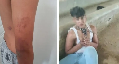 Ahırda zincirli işkence iddiası: Baba, amca ve ağabeye gözaltı