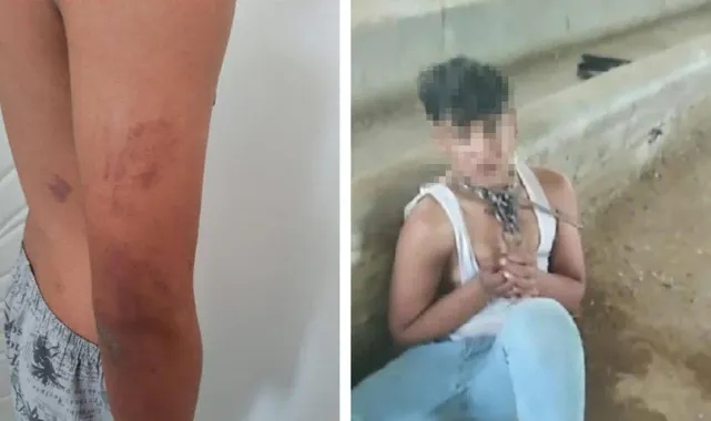 Ahırda zincirli işkence iddiası: Baba, amca ve ağabeye gözaltı