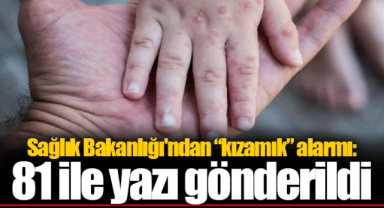Sağlık Bakanlığı'ndan “kızamık” alarmı: 81 ile yazı gönderildi