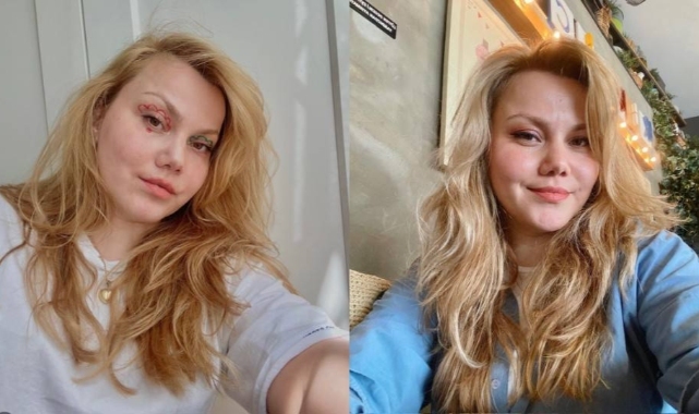 YouTuber Merve Veziroğlu Yıldırım, evli olduğu erkek tarafından bıçaklandI